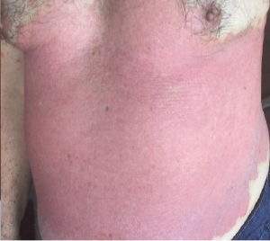 Correct front before